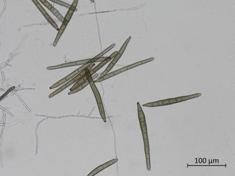 Corynespora_cassiicola_3