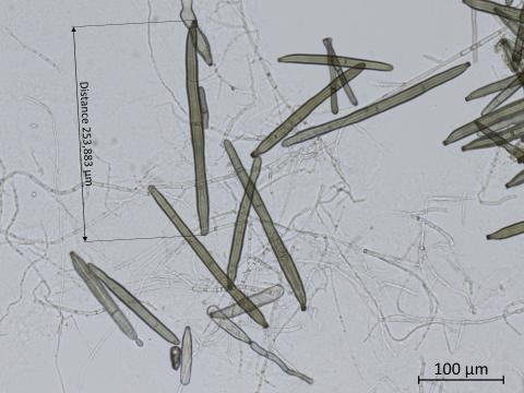 Corynespora_cassiicola_4