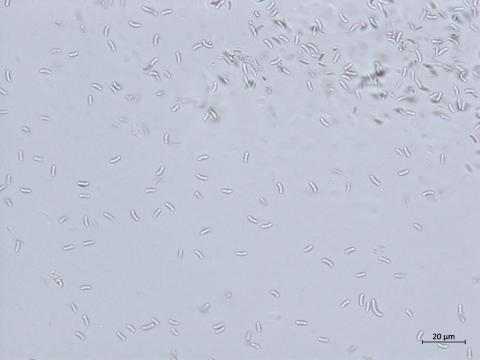 Cytospora_chrysosperma_2