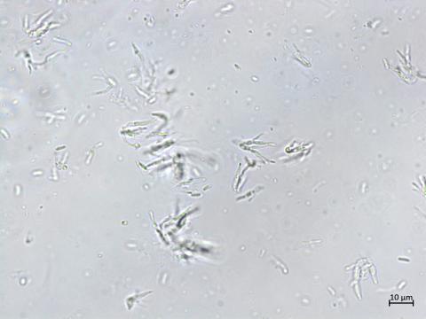 Cytospora_sp_2
