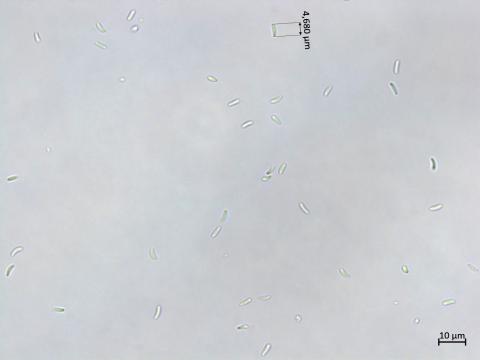 Cytospora_chrysosperma_3