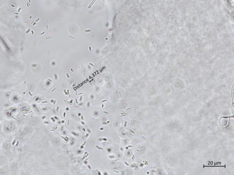 Cytospora_sp_5