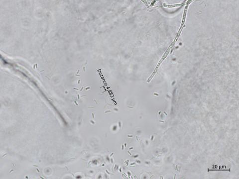 Cytospora_chrysosperma_8