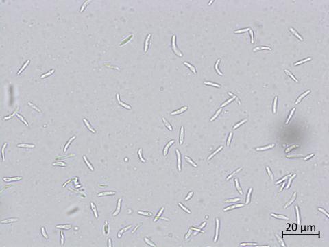 Diaporthe_caulivora_3