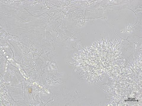 Diaporthe_caulivora_1