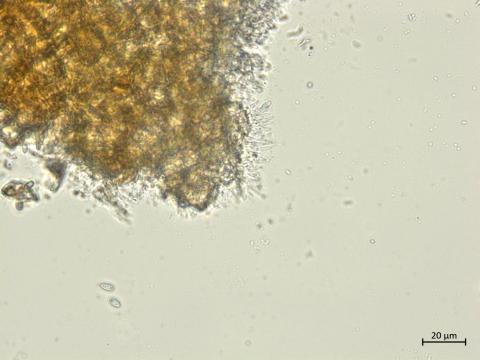 Diaporthe_vaccinii_2