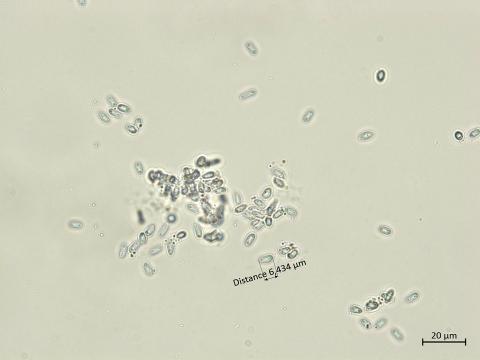 Diaporthe_vaccinii_3