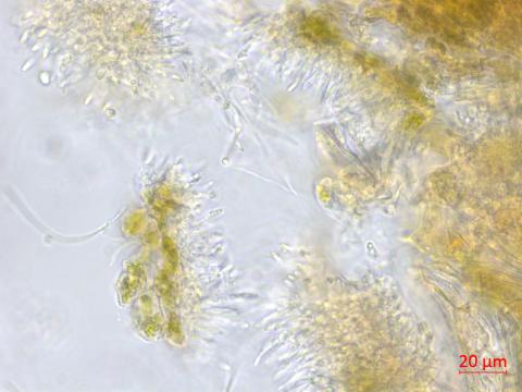 Diaporthe_viticola_2