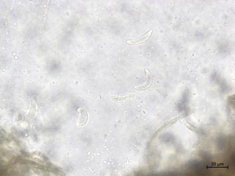 Drepanopeziza_ribis_1