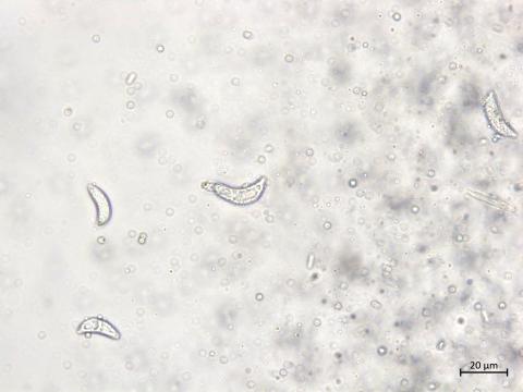 Drepanopeziza_ribis_3