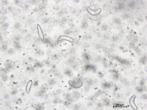 Drepanopeziza_ribis_4