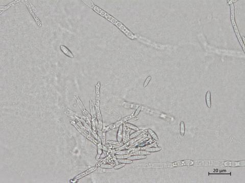 Fusarium_sporotrichioides_1