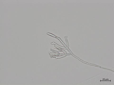 Fusarium_sporotrichioides_4