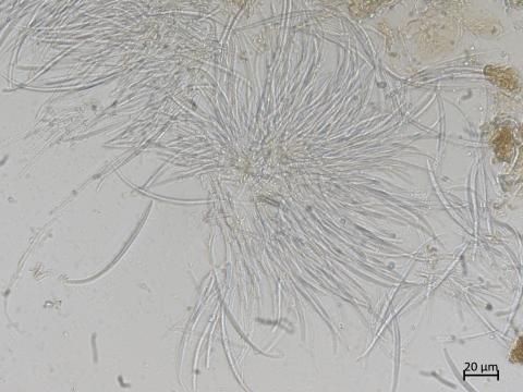 Fusarium_tricinctum_1