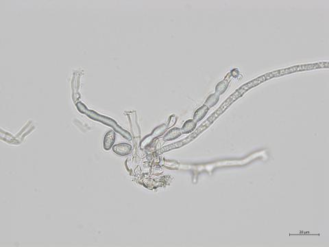 Monilinia_fructicola_1