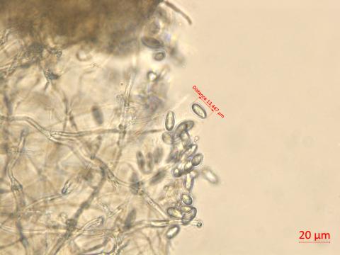 Neofusicoccum_parvum_7