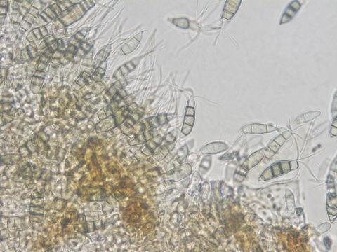 Neopestalotiopsis_clavispora_1