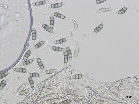 Neopestalotiopsis_clavispora_2