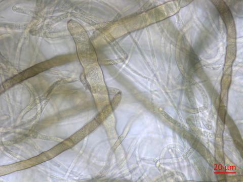 Pyrenophora_tritici-repentis_1