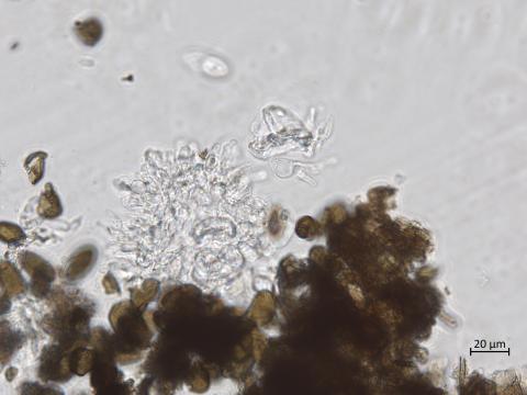 Diplodia_seriata_14