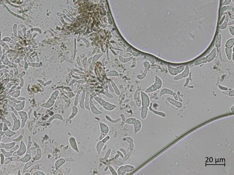 Diplocarpon_fragariae_8