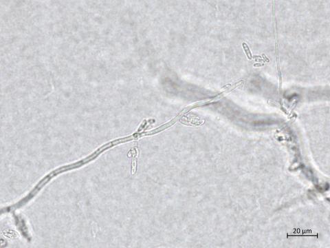 Neocosmospora_phaseoli_6