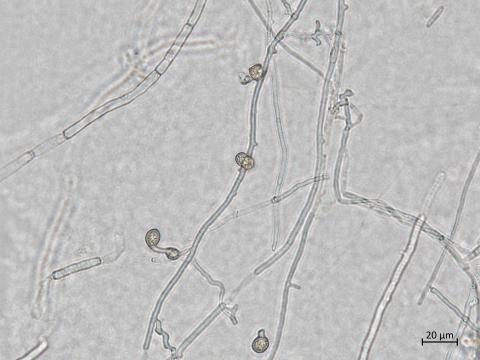 Neocosmospora_phaseoli_7