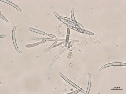Neocosmospora_phaseoli_10