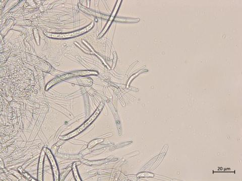 Neocosmospora_phaseoli_11