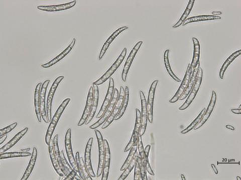 Neocosmospora_pisi_2