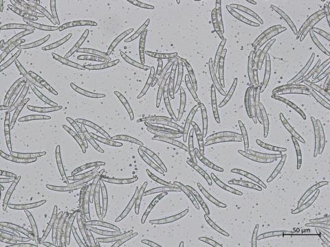 Thelonectria_veuillotiana_1